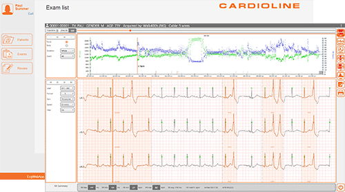 ECGWebApp Holter Software
