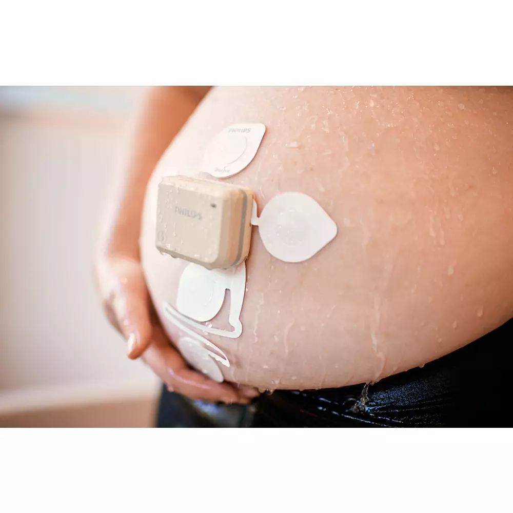 Avalon beltless fetal monitoring solution